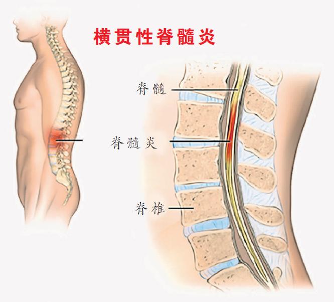 这是一项大挑战