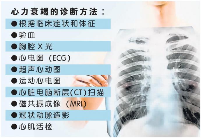 心力衰竭的诊断方法 图表