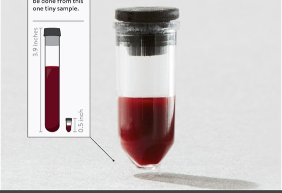 Theranos宣称这么少量的血可以检测出疾病，与之相对的是传统的抽血量。很多美国知名投资者相信了这个“伟大的科技”还因此损失大笔资金。 