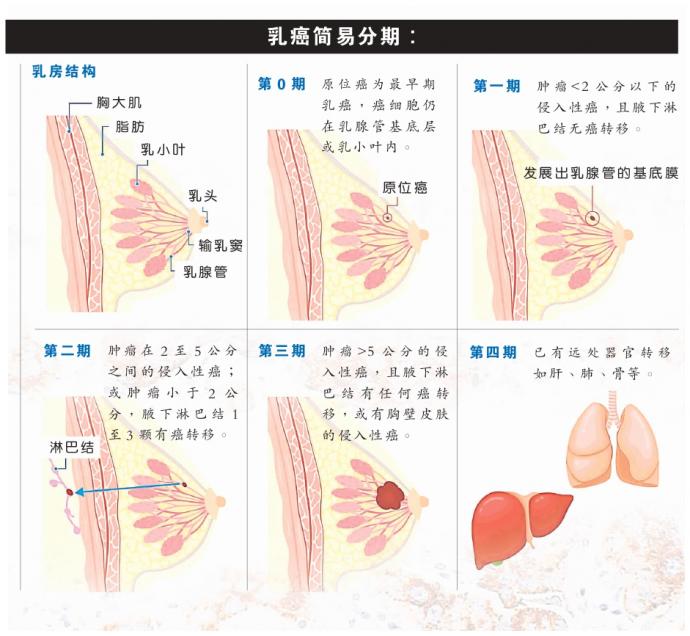 乳癌 图表