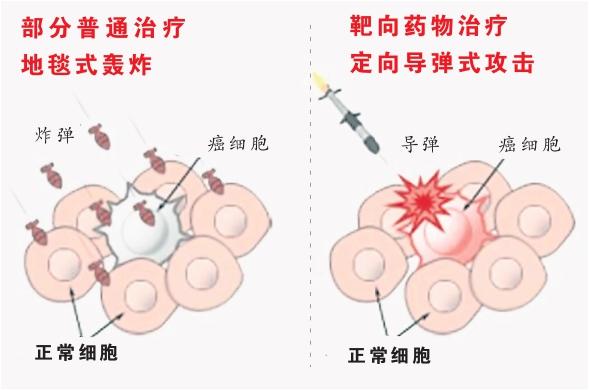 靶向药物治疗