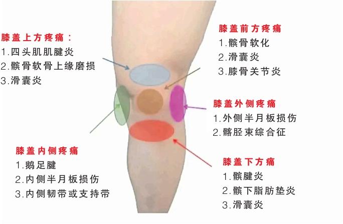 膝盖疼痛