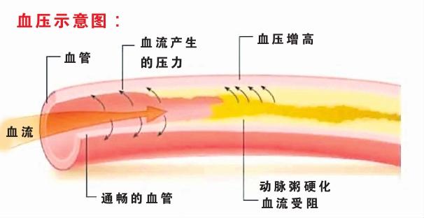 血压示意图