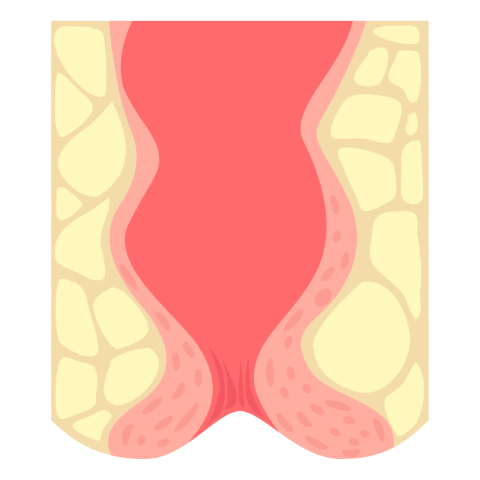 痔疮 肛门