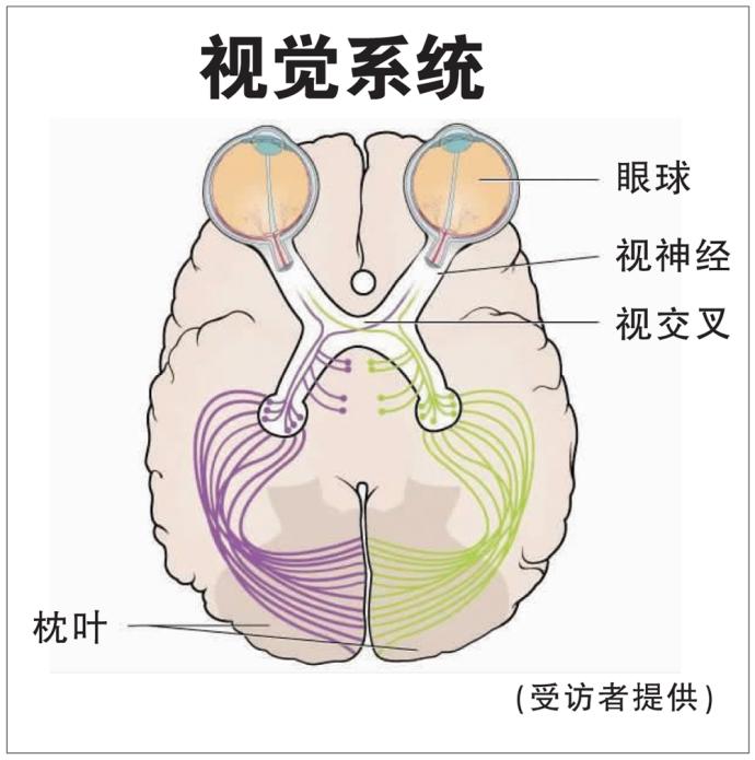 视觉系统