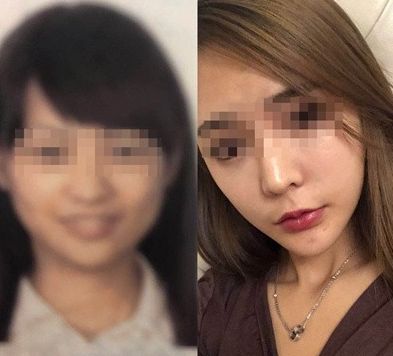 事主坦承4年前曾做过医美手术“动过下巴”，但因外貌与身分证差距过大，到机场安检时被拦下而错过班机。（网络图）